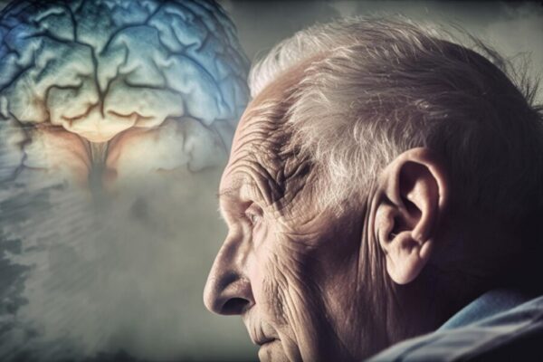 Alzheimerjeva bolezen